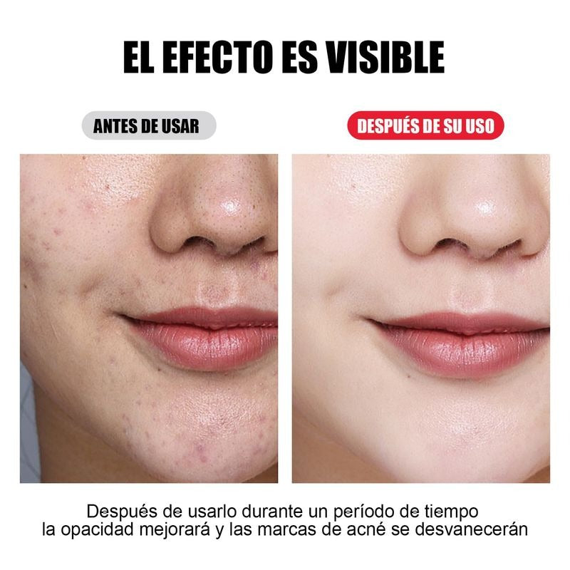 MASCARA LED REJUVENECEDORA